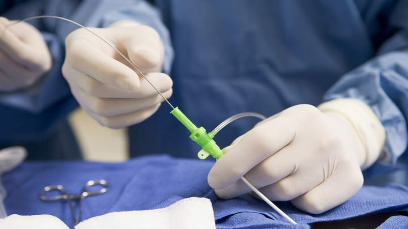 آنژیوگرافی قلب چگونه انجام میشود؟ | متخصص قلب اصفهان 